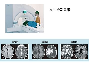 MRI撮影風景　脳室を通る水平断面のMRI断層画像